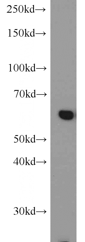 mouse kidney tissue were subjected to SDS PAGE followed by western blot with Catalog No:108942(CBS antibody) at dilution of 1:500