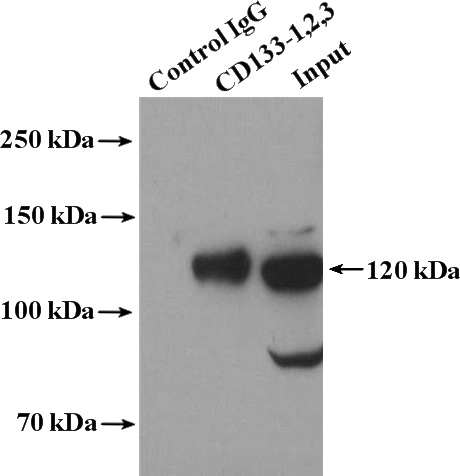 IP Result of anti-CD133-1,2,3 (IP:Catalog No:109049, 4ug; Detection:Catalog No:109049 1:300) with Y79 cells lysate 2000ug.