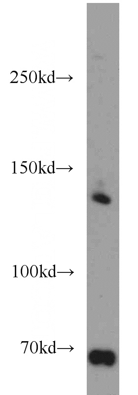 HeLa cells were subjected to SDS PAGE followed by western blot with Catalog No:111335(hamartin antibody) at dilution of 1:1000