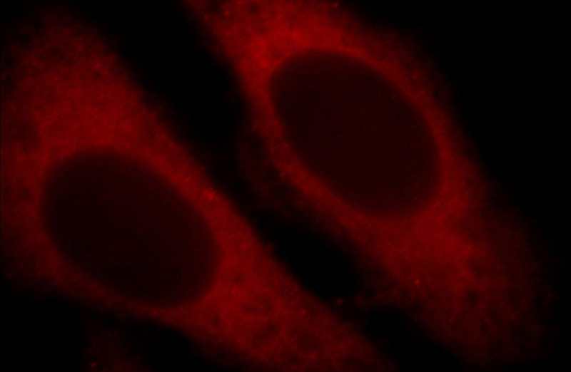 Immunofluorescent analysis of HepG2 cells, using ARF5 antibody Catalog No:108248 at 1:25 dilution and Rhodamine-labeled goat anti-rabbit IgG (red).