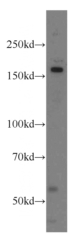 K-562 cells were subjected to SDS PAGE followed by western blot with Catalog No:113201(NKTR antibody) at dilution of 1:500