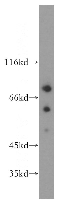 SH-SY5Y cells were subjected to SDS PAGE followed by western blot with Catalog No:109843(DEAF1 antibody) at dilution of 1:500