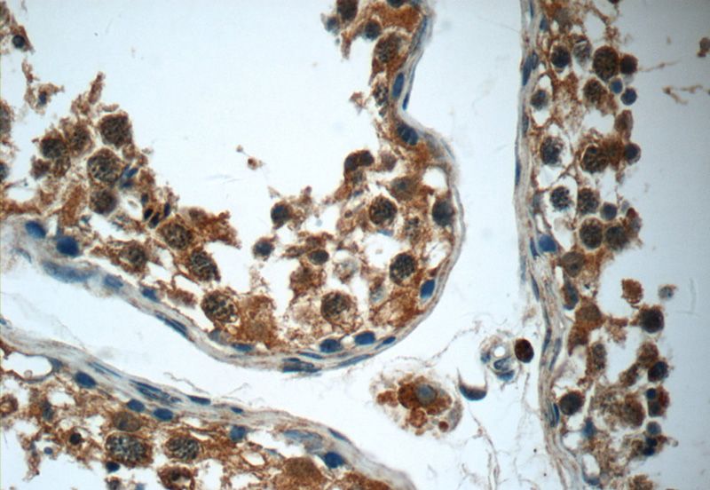 Immunohistochemistry of paraffin-embedded human testis tissue slide using Catalog No:114914(RPS6KL1 Antibody) at dilution of 1:50 (under 40x lens)