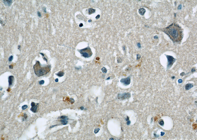 Immunohistochemical of paraffin-embedded human brain using Catalog No:107615(STX6 antibody) at dilution of 1:50 (under 40x lens)