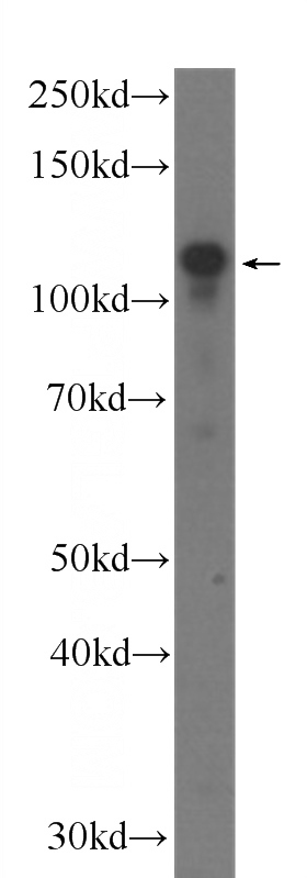 fetal human brain tissue were subjected to SDS PAGE followed by western blot with Catalog No:107022(BRD8 Antibody) at dilution of 1:1000