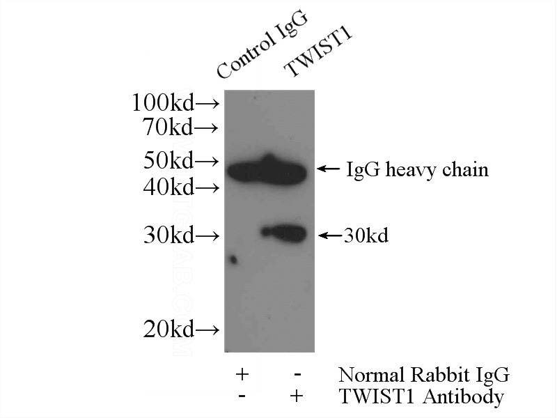 IP Result of anti-TWIST1 (IP:Catalog No:116502, 4ug; Detection:Catalog No:116502 1:500) with MDA-MB-453s cells lysate 920ug.