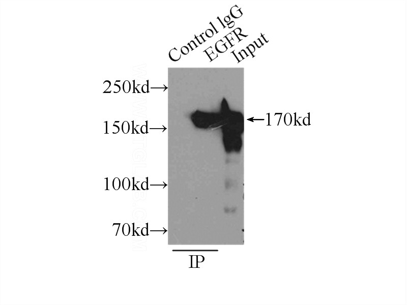 IP Result of anti-EGFR (IP:Catalog No:110216, 5ug; Detection:Catalog No:110216 1:500) with A431 cells lysate 3000ug.