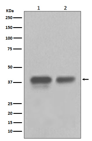 Western blot analysis of CDX2 in (1) HEK293 cell lysate; (2) Colon cancer lysate.