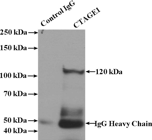 IP Result of anti-CTAGE1 (IP:Catalog No:109621, 4ug; Detection:Catalog No:109621 1:500) with HeLa cells lysate 2400ug.