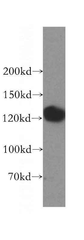HeLa cells were subjected to SDS PAGE followed by western blot with Catalog No:111237(GTF2IRD1 antibody) at dilution of 1:500