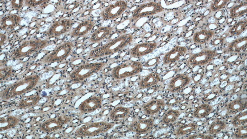 Immunohistochemical of paraffin-embedded human kidney using Catalog No:113268(NR3C2 antibody) at dilution of 1:50 (under 10x lens)