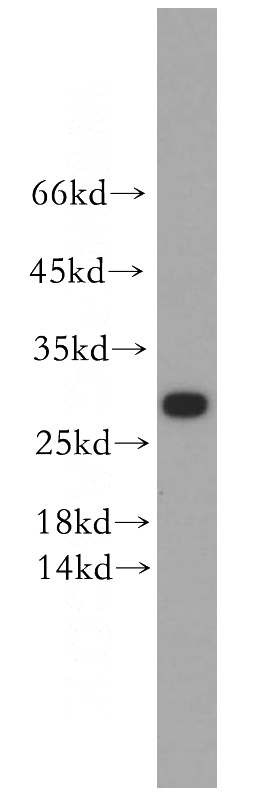 human skeletal muscle tissue were subjected to SDS PAGE followed by western blot with Catalog No:111929(KCNE4 antibody) at dilution of 1:300