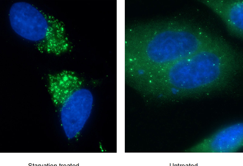 Immunofluorescent analysis of (-20oc Ethanol) fixed Starvation treated HepG2 cells using Catalog No:107447(P62;SQSTM1 Antibody) at dilution of 1:100 and Alexa Fluor 488-congugated AffiniPure Goat Anti-Mouse IgG(H+L)