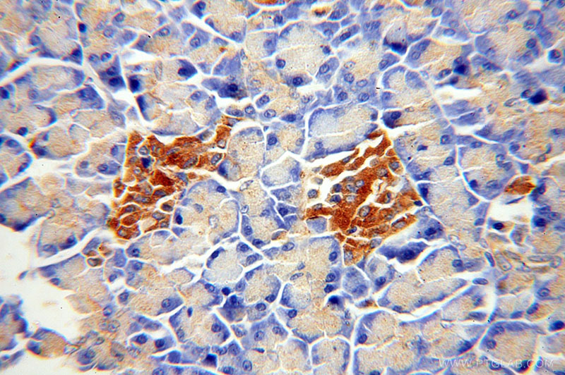 Immunohistochemical of paraffin-embedded human pancreas using Catalog No:108305(ATP6V1A antibody) at dilution of 1:100 (under 40x lens)