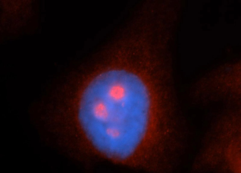 Immunofluorescent analysis of HepG2 cells, using MYBBP1A antibody Catalog No:112912 at 1:50 dilution and Rhodamine-labeled goat anti-rabbit IgG (red). Blue pseudocolor = DAPI (fluorescent DNA dye).
