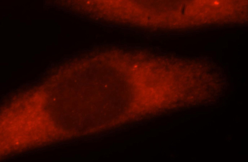 Immunofluorescent analysis of Hela cells, using ATXN10 antibody Catalog No:117068 at 1:25 dilution and Rhodamine-labeled goat anti-rabbit IgG (red).