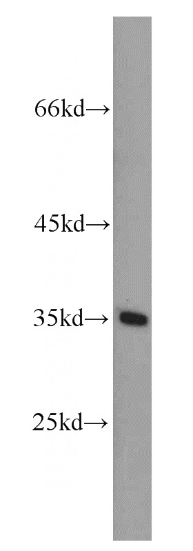 MCF7 cells were subjected to SDS PAGE followed by western blot with Catalog No:110073(ECSA antibody) at dilution of 1:500