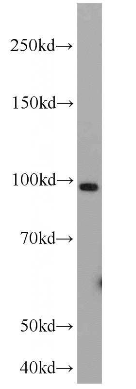 A549 cells were subjected to SDS PAGE followed by western blot with Catalog No:111222(HSP90B1 antibody) at dilution of 1:1000
