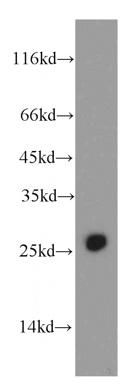 mouse skeletal muscle tissue were subjected to SDS PAGE followed by western blot with Catalog No:108024(APOBEC2 antibody) at dilution of 1:500