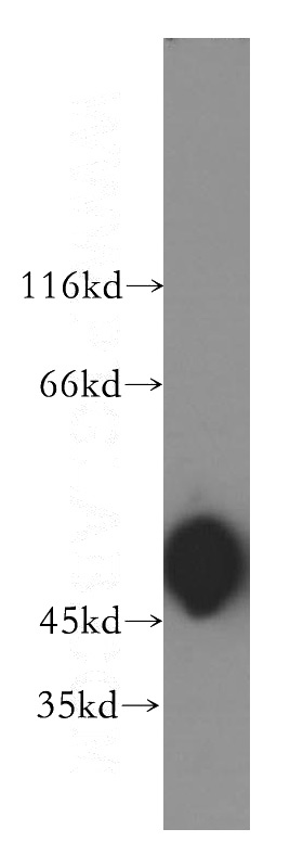 human brain tissue were subjected to SDS PAGE followed by western blot with Catalog No:107751(ACTR3B antibody) at dilution of 1:800