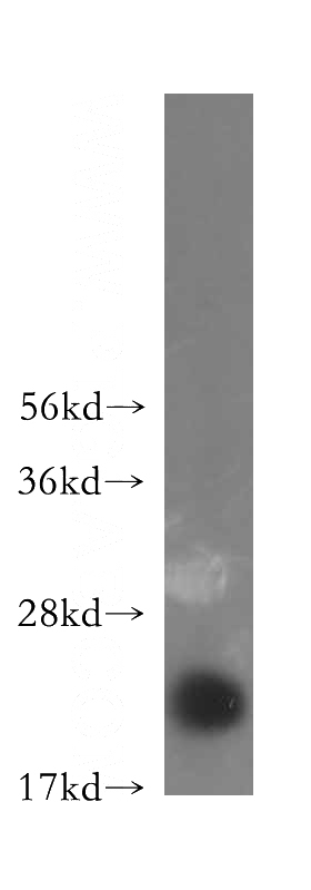 human colon tissue were subjected to SDS PAGE followed by western blot with Catalog No:108827(CALML4 antibody) at dilution of 1:300