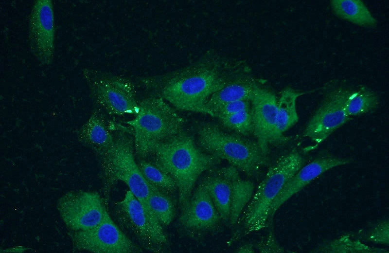 Immunofluorescent analysis of A549 cells using Catalog No:116774(VPS18 Antibody) at dilution of 1:50 and Alexa Fluor 488-congugated AffiniPure Goat Anti-Rabbit IgG(H+L)