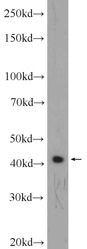 SH-SY5Y cells were subjected to SDS PAGE followed by western blot with Catalog No:108142(APLNR Antibody) at dilution of 1:600