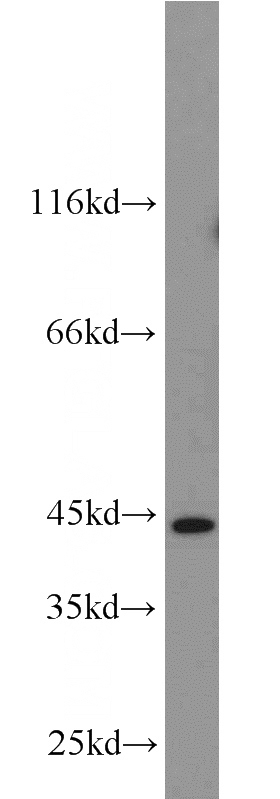 K-562 cells were subjected to SDS PAGE followed by western blot with Catalog No:113526(OXER1 antibody) at dilution of 1:500