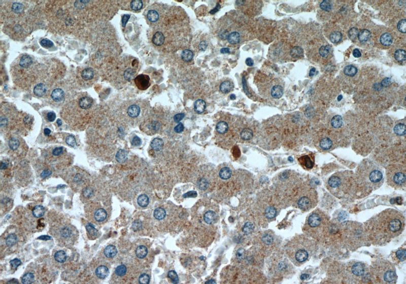Immunohistochemical of paraffin-embedded human liver using Catalog No:116088(TMED9 antibody) at dilution of 1:50 (under 40x lens)