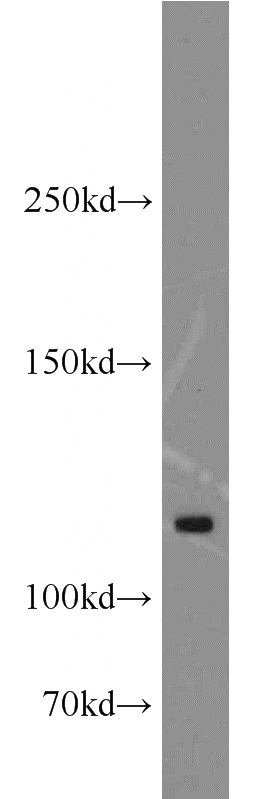 mouse ovary tissue were subjected to SDS PAGE followed by western blot with Catalog No:108102(ANO3 antibody) at dilution of 1:500