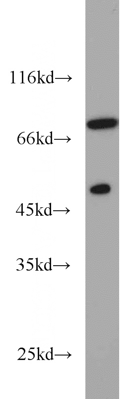 K-562 cells were subjected to SDS PAGE followed by western blot with Catalog No:111230(GTF2F1 antibody) at dilution of 1:1000