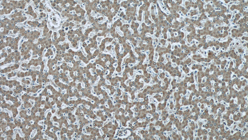 Immunohistochemical of paraffin-embedded human liver using Catalog No:116709(VAMP7 antibody) at dilution of 1:50 (under 10x lens)