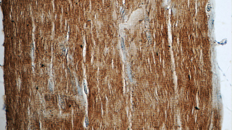 Immunohistochemistry of paraffin-embedded human skeletal muscle tissue slide using Catalog No:110166(MAPRE3 Antibody) at dilution of 1:50 (under 40x lens)