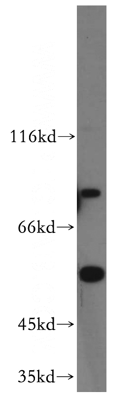 HeLa cells were subjected to SDS PAGE followed by western blot with Catalog No:108798(C9orf156 antibody) at dilution of 1:300