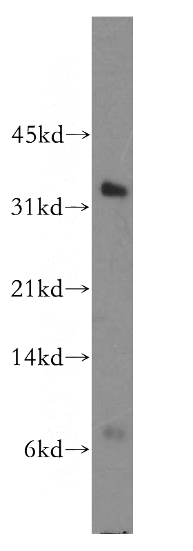human kidney tissue were subjected to SDS PAGE followed by western blot with Catalog No:114040(POLR2C antibody) at dilution of 1:500