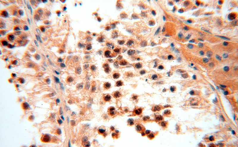 Immunohistochemical of paraffin-embedded human testis using Catalog No:108018(AMZ2 antibody) at dilution of 1:50 (under 40x lens)