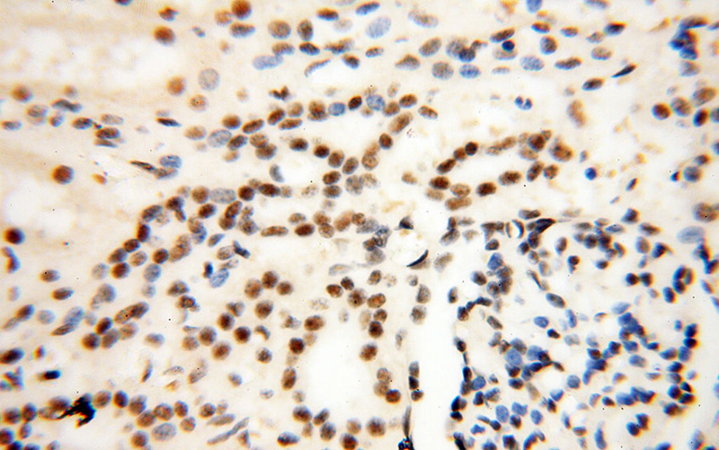 Immunohistochemical of paraffin-embedded human kidney using Catalog No:116050(THoc7 antibody) at dilution of 1:100 (under 40x lens)