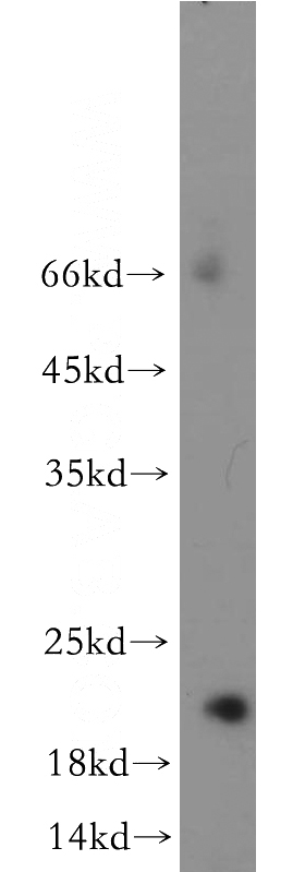 human heart tissue were subjected to SDS PAGE followed by western blot with Catalog No:114752(RNF212 antibody) at dilution of 1:500