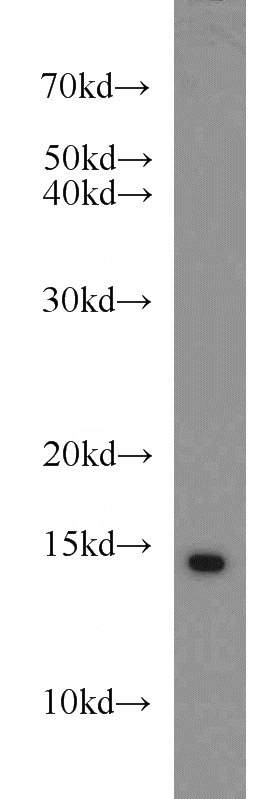 MCF7 cells were subjected to SDS PAGE followed by western blot with Catalog No:115462(SNRPD3 antibody) at dilution of 1:500