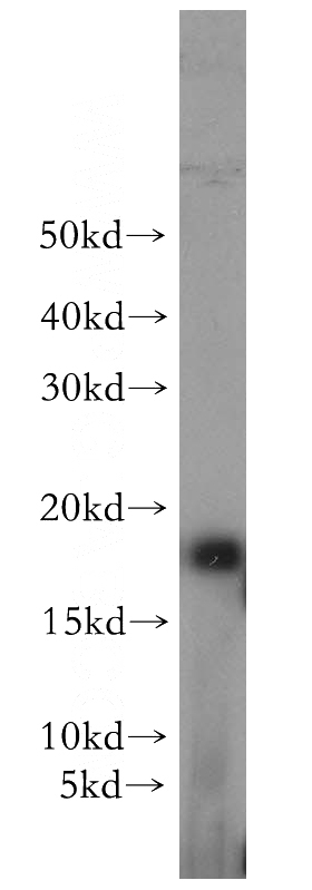mouse kidney tissue were subjected to SDS PAGE followed by western blot with Catalog No:110771(GABARAPL1 antibody) at dilution of 1:500