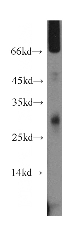 mouse pancreas tissue were subjected to SDS PAGE followed by western blot with Catalog No:110067(DPM1 antibody) at dilution of 1:500