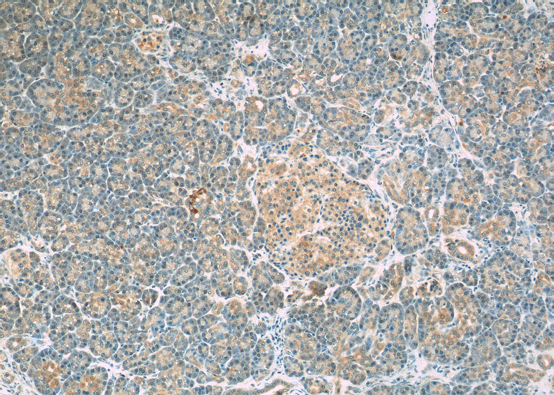 Immunohistochemistry of paraffin-embedded human pancreas slide using Catalog No:113717(EIF2AK3 Antibody) at dilution of 1:50