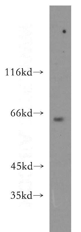 mouse eye tissue were subjected to SDS PAGE followed by western blot with Catalog No:109101(CDC2L6 antibody) at dilution of 1:300