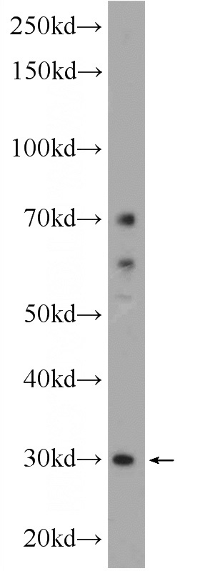K-562 cells were subjected to SDS PAGE followed by western blot with Catalog No:116197(TMEM77 Antibody) at dilution of 1:600