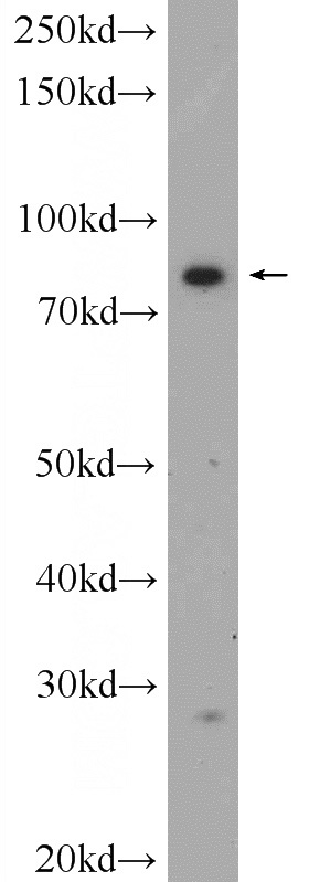 PC-3 cells were subjected to SDS PAGE followed by western blot with Catalog No:110591(FAM48A Antibody) at dilution of 1:300