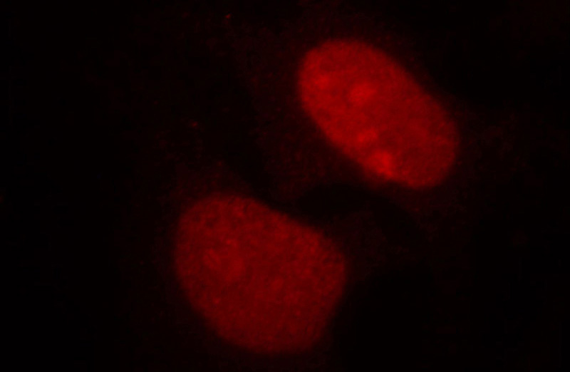 Immunofluorescent analysis of Hela cells, using HDGF antibody Catalog No: at 1:25 dilution and Rhodamine-labeled goat anti-mouse IgG (red).