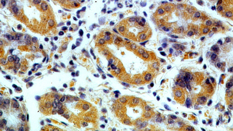 Immunohistochemical of paraffin-embedded human stomach using Catalog No:112847(MRPS2 antibody) at dilution of 1:100 (under 40x lens)