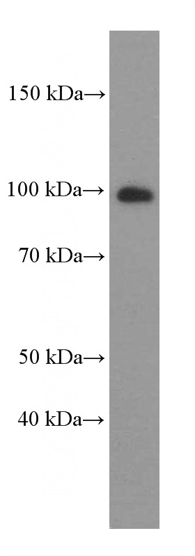 human testis tissue were subjected to SDS PAGE followed by western blot with Catalog No:107566(AKAP3 Antibody) at dilution of 1:2000