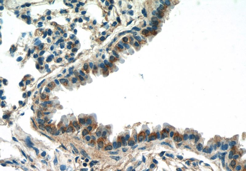 Immunohistochemistry of paraffin-embedded mouse lung tissue slide using Catalog No:109754(DCP1A Antibody) at dilution of 1:50 (under 40x lens)