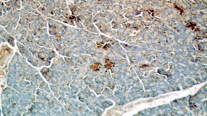 Immunohistochemical of paraffin-embedded human pancreas using Catalog No:115439(SMYD4 antibody) at dilution of 1:50 (under 10x lens)